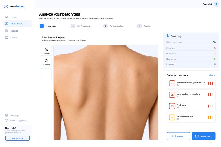 tele-derma patch test analyzer interface with an uploaded test and reaction summary