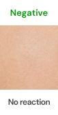 Negative patch test result
